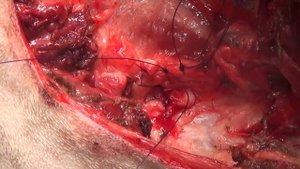 Хирургическая техника тотальной ампутации грудной конечности у собак