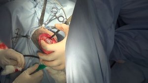 Техника сулькопластики у собак