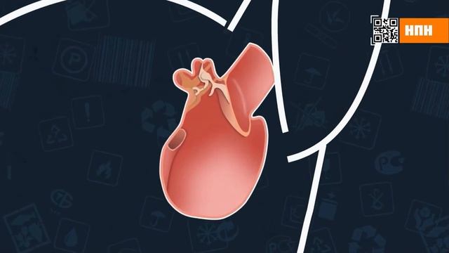 Особенности выбора ультразвукового отпугивателя грызунов. Правда про отпугиватели #крысы #мыши