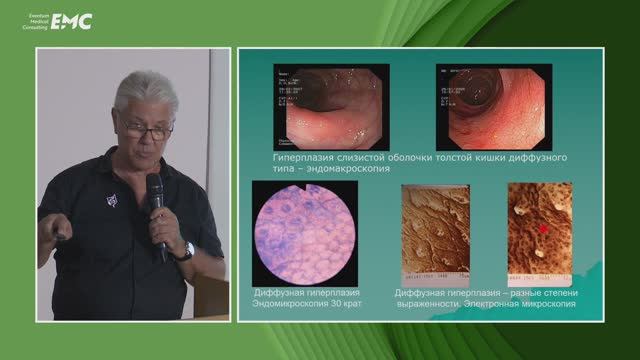 Рак толстой кишки с быстрыми темпами роста. Ханкин С.Л., Рубцов В.С., Федотов Э.А., Напшева А.М.