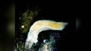 Паразитирующие черви в инжире #подмикроскопом #гельминты #паразиты