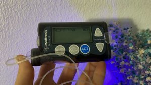 ИНСУЛИНОВАЯ ПОМПА БЕСПЛАТНО / Как получить инсулиновую помпу / Помпа медтроник 720g