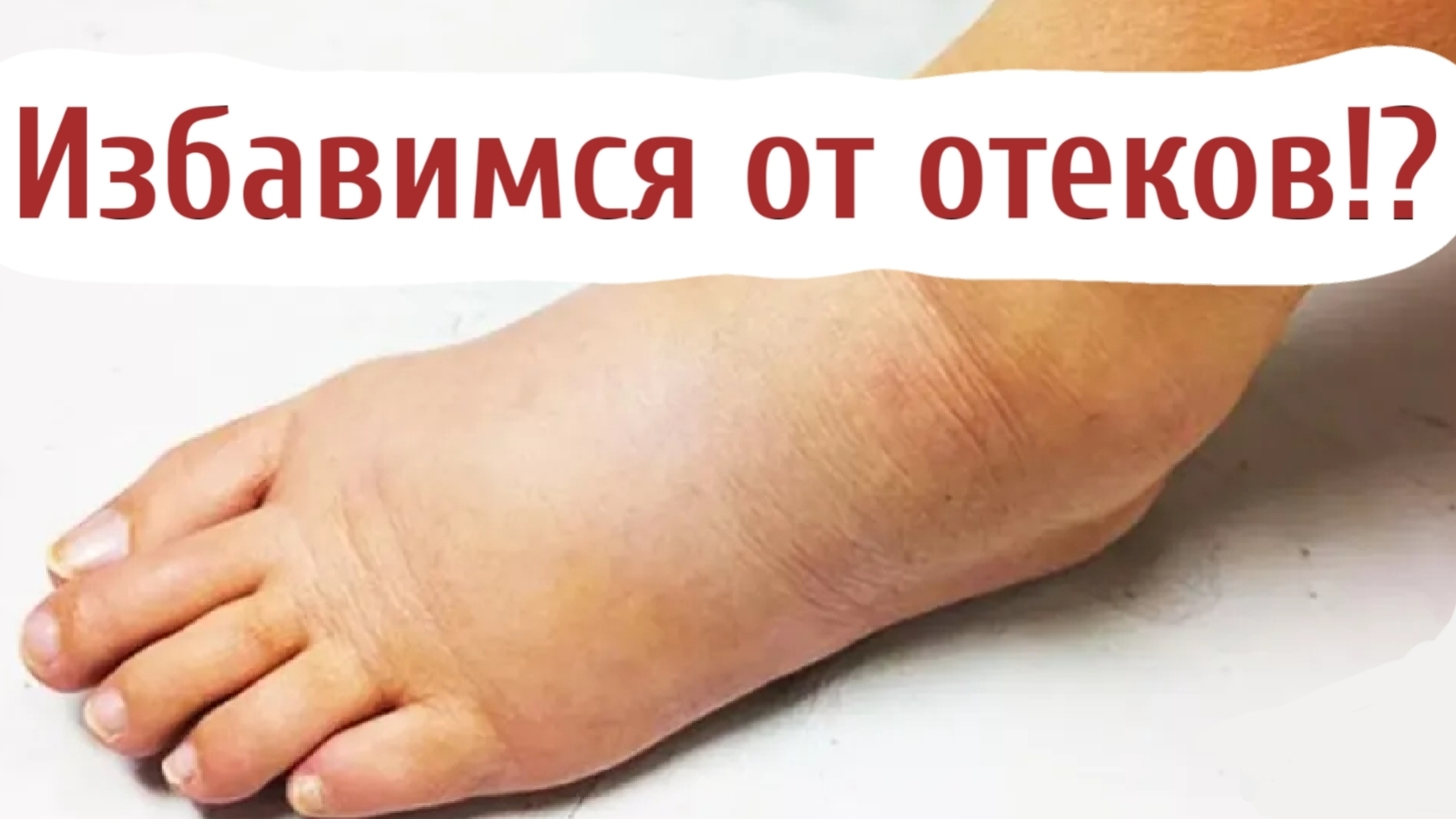 Избавимся от отеков?!