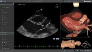 Трансторакальная эхокардиография (сдаём аккредитацию)