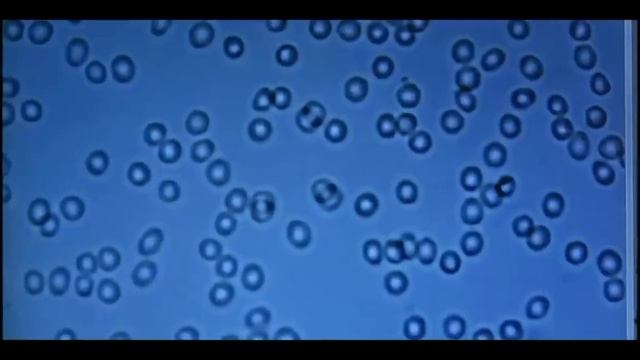 Заземление Фильм о заземлении человека #заземление #здоровье #человек #оздоровление #земля