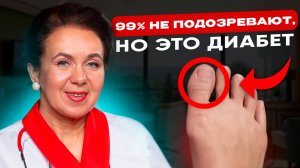 Еще нет ДИАБЕТА, но есть 13 признаков высокого САХАРА! Что делать?