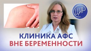 Клинические проявления антифосфолипидного синдрома вне беременности. Дрожжина А.И.