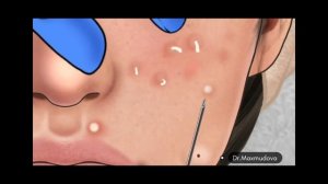 Юзни механик тозалаш.