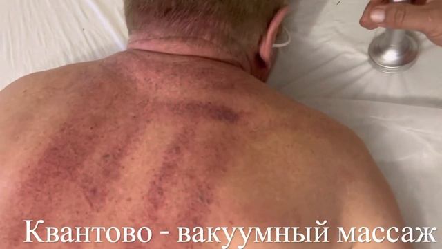 Квантово-вакуумный массаж. Терапия вакуумная. Массаж аппаратный. Мануал. Остеопатия. Лимфодренаж