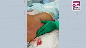 Липосакция зоны "галифе". Как убрать "ушки" на бедрах