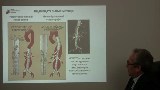 АО-09.  Рентгенэндоваскулярные вмешательства