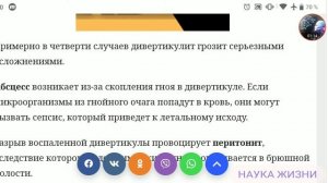 Дивертикулит Симптомы