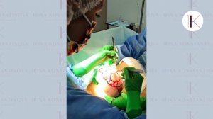 Устранение асимметрии молочных желез. Подтяжка и редукция груди. Съемка с операционного стола
