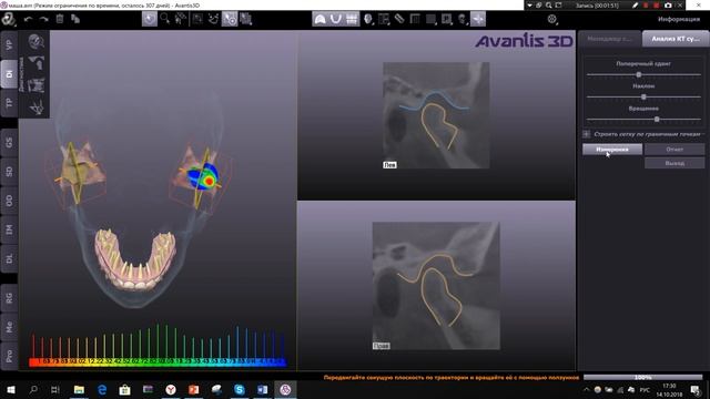 Анализ ВНЧС