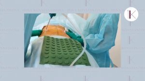 Как проводится липосакция? Съемка с операционного стола