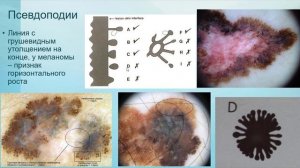 Тема 02. Дерматоскопический алфавит