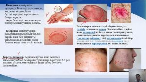 Тері аурулары және гигиенасы