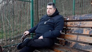 ✅ КЕРАТОКОНУС 👨⚕️ Через 3 НЕДЕЛИ после операции на обоих глазах в клинике Арцыбашева 🏥