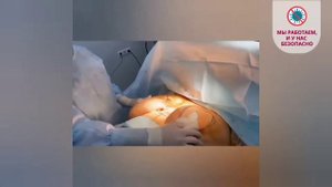 Результат уменьшения груди 13-го размера спустя 2 месяца! Хирург Константинова Ирина