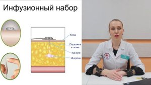 Инфузионные наборы.