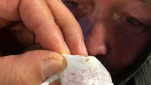 Лечение глаз. Восстановление зрения. Лечим зуд в глазах. Сухость глаз. Покраснение глаз