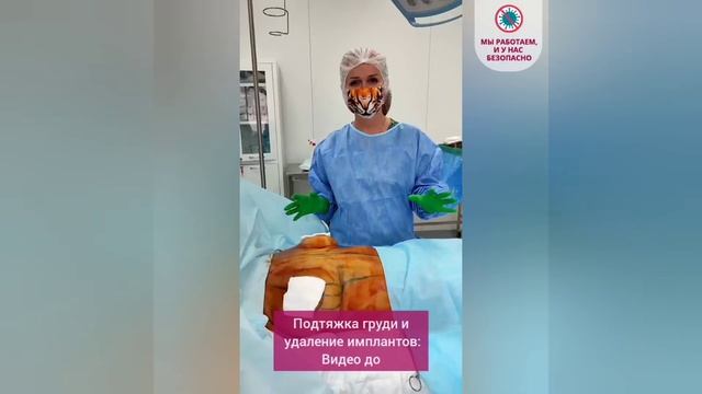 Удаление имплантов с одновременной подтяжкой груди. Результат с операционного стола