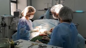 Красивая грудь без имплантов - мастопексия. Хирург Константинова И.В.