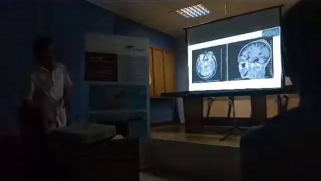 Лазарев А.Ю. - Комбинированная пластика дефекта основания черепа при краниофациальной резекции