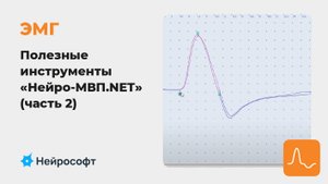 ЭМГ: Полезные инструменты в работе с ПО «Нейро-МВП.NET» (часть 2)