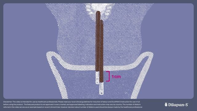 SaveTube.io-Insertion process of DILAPAN-S step by step смотреть онлайн