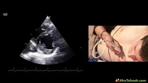 Эхокардиография. Секреты визуализации