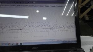 Неравномерная работа двигателя 2UZ FE