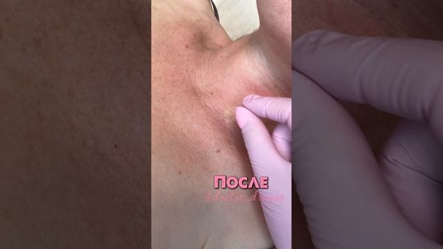 Cегодня хотим поделиться работой филлерами бренда PHILOS #philos