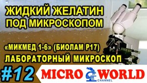 Старый желатиновый бульон под микроскопом - MICRO WORLD #12