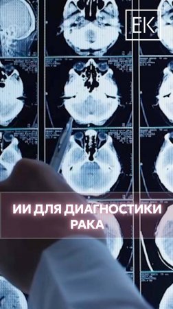 Искусственный интеллект в области диагностики рака