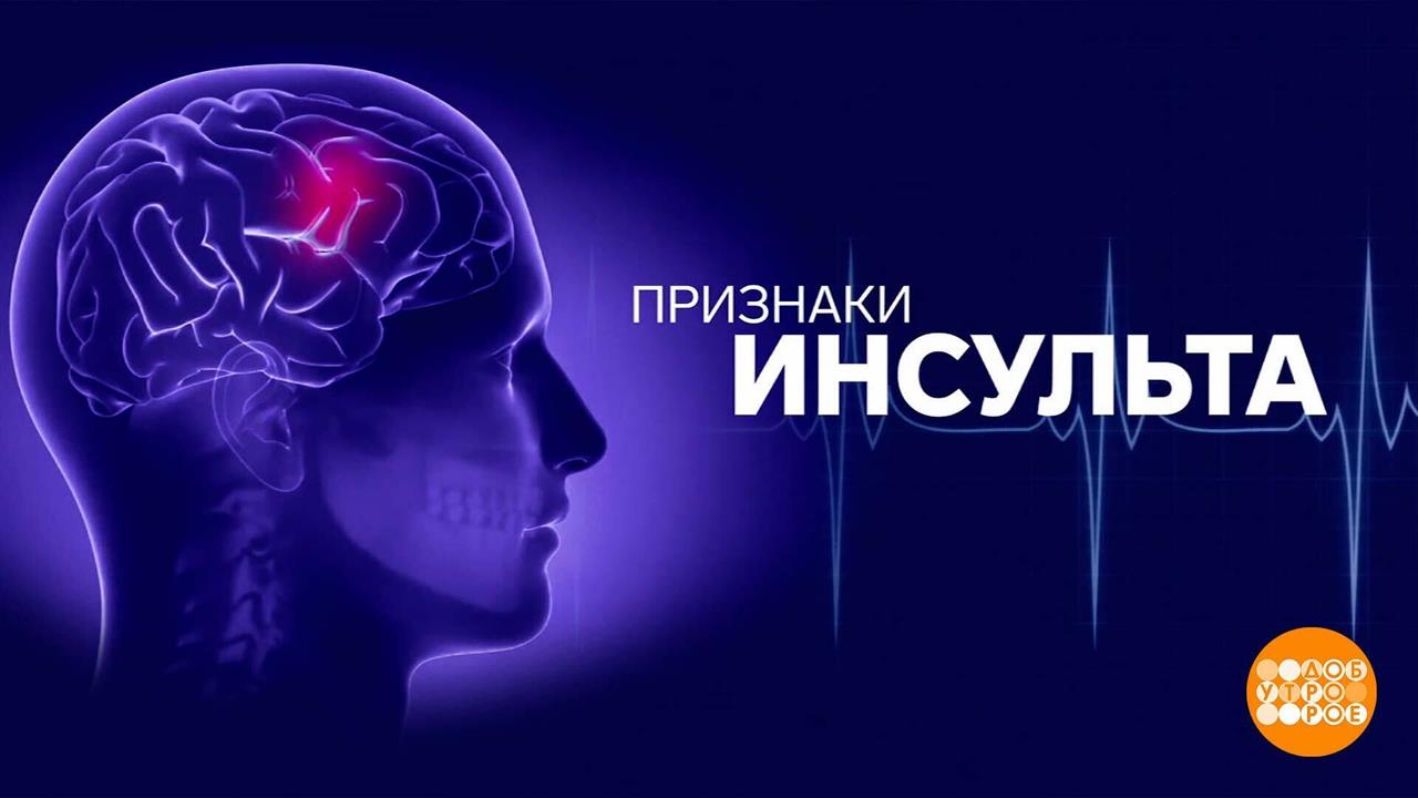 Инсульт: главное - не упустить время! Доброе утро. Фрагмент выпуска от 29.10.2024