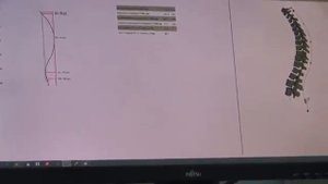 3 3D Newton - гравитационная терапия, гимнастика и лечение спины