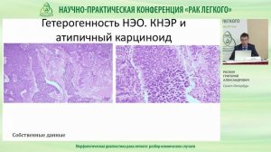 Саркома интимы легочной артерии