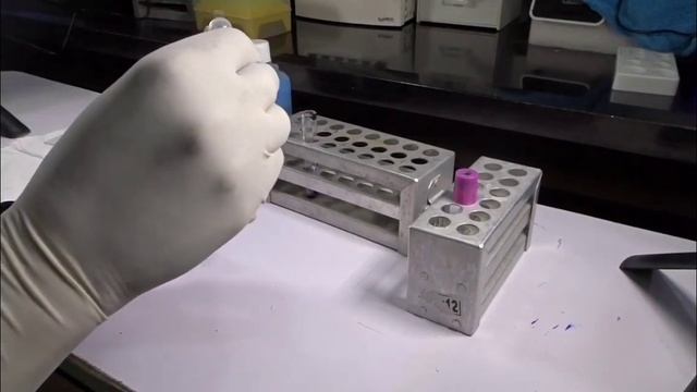 Reticulocyte count procedure and calculation # pathology lab #dmlt lab