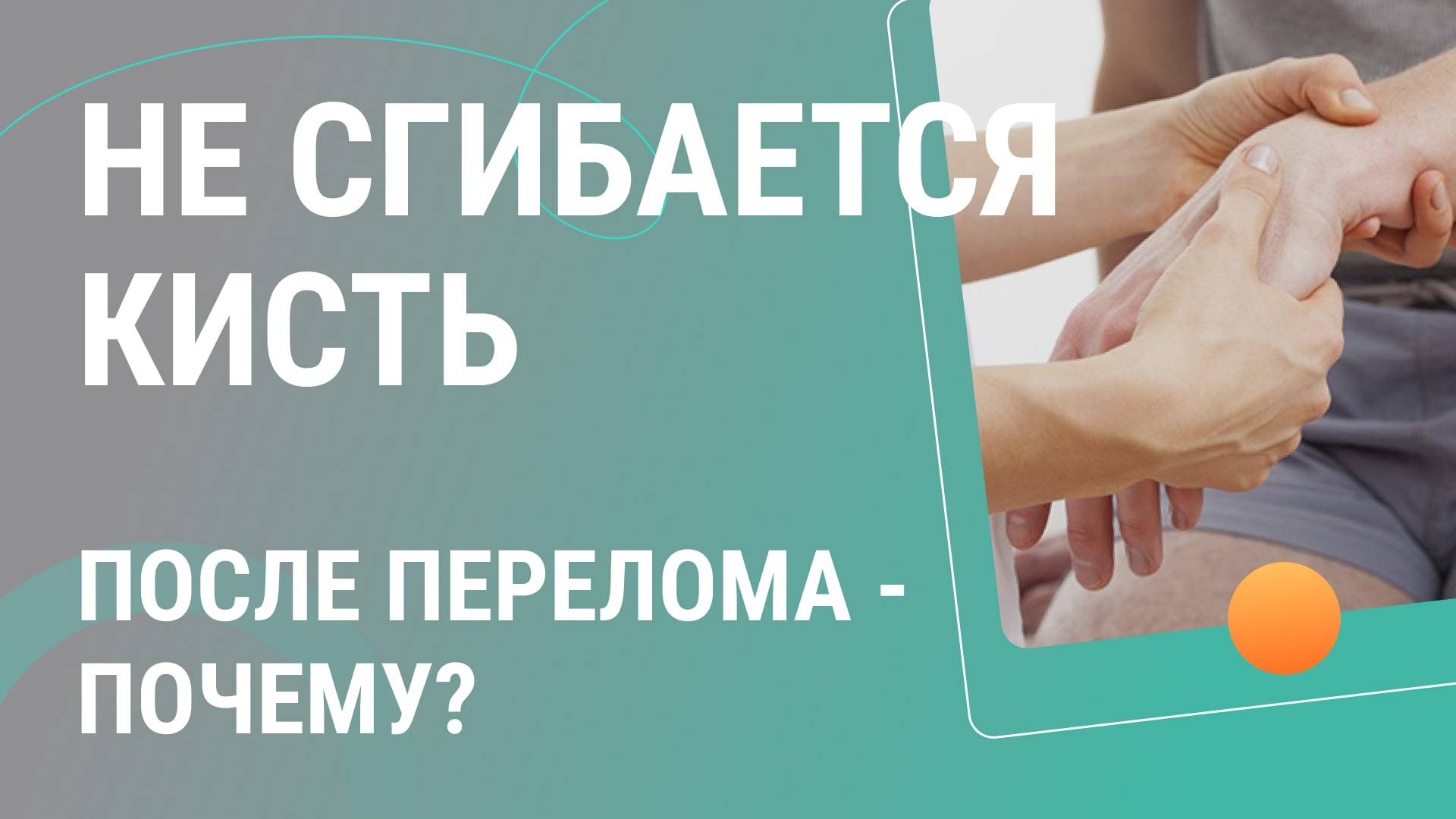 Почему не сгибается кисть после перелома?