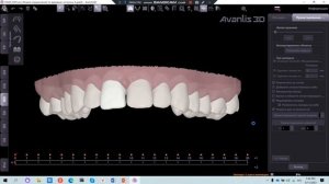 Проектирование моделей для элайнеров
