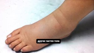 10 Невероятных Средств от Опухших Лодыжек и Ступней