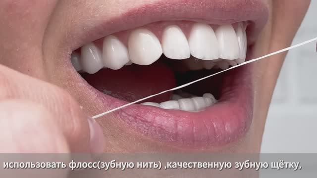 Рекомендации после отбеливания зубов