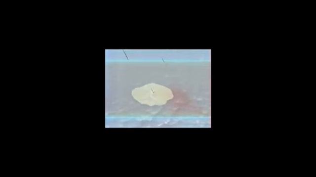 Современные методы лечения акне. Часть1.mp4 смотреть онлайн