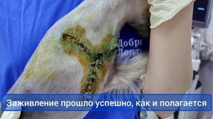 Снятие швов после операции