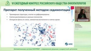 Автоматическая система EASYPREP – современное решение в жидкостной цитологии