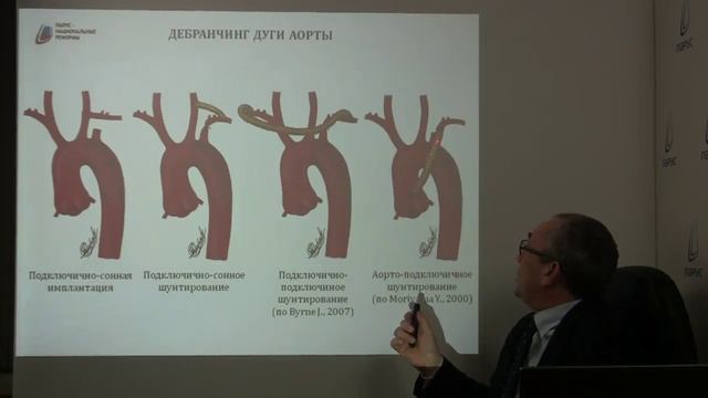 РА-23.  Гибридные вмешательства. Дебранчинг