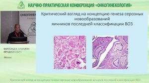 Критический взгляд на концепцию генеза серозных новообразований яичников