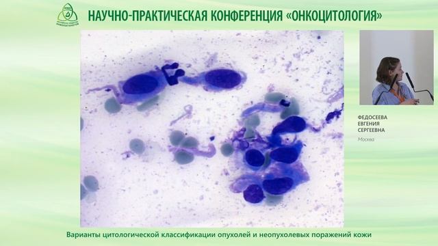 Варианты цитологической классификации опухолей и неопухолевых поражений кожи
