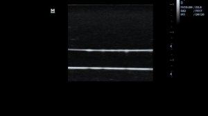 УЛЬТРАЗВУКОВОЙ ФАНТОМ GELATEXA SIBT - Артерия Линейный датчик